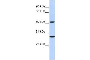 Western Blotting (WB) image for anti-Glutathione S-Transferase mu 5 (GSTM5) antibody (ABIN2459201) (GSTM5 Antikörper)