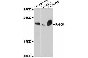 Western blot analysis of extracts of various cell lines, using RAB25 antibody (ABIN6290827) at 1:3000 dilution. (RAB25 Antikörper)