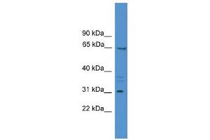 WB Suggested Anti-MEPE Antibody Titration:  0. (MEPE Antikörper  (Middle Region))