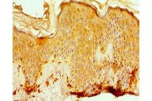 Immunohistochemistry of paraffin-embedded human skin tissue using ABIN7142077 at dilution of 1:100 (EFTUD2 Antikörper  (AA 1-205))
