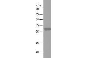 Western Blotting (WB) image for Brain Natriuretic Peptide (BNP) (AA 27-121) protein (His-IF2DI Tag) (ABIN7122023) (BNP Protein (AA 27-121) (His-IF2DI Tag))