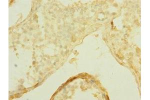 Immunohistochemistry of paraffin-embedded human testis tissue using ABIN7170303 at dilution of 1:100 (SLCO2B1 Antikörper  (AA 130-210))