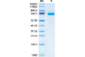 IL20RA Protein (AA 33-253) (Fc Tag)