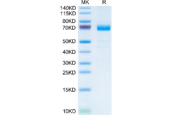IL20RA Protein (AA 33-253) (Fc Tag)