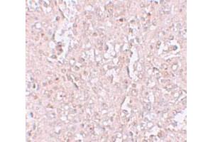 Immunohistochemical staining of human spleen cells with SLC39A13 polyclonal antibody  at 2. (SLC39A13 Antikörper  (N-Term))