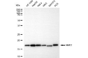 Western blotting analysis using NME2 antibody (ABIN7799681). (Rekombinanter NME2 Antikörper)