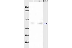 Lane 1: mouse embryo lysates Lane 2: mouse brain lysates probed with Anti TNFAIP5/Pentraxin 3 Polyclonal Antibody, Unconjugated (ABIN714686) at 1:200 in 4 °C.