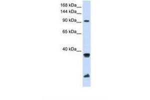 Image no. 1 for anti-Ring Finger Protein 20 (RNF20) (AA 576-625) antibody (ABIN6738066) (RNF20 Antikörper  (AA 576-625))