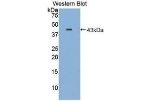 Detection of Recombinant MBP, Mouse using Polyclonal Antibody to Major Basic Protein (MBP) (Major Basic Protein Antikörper  (AA 100-215))