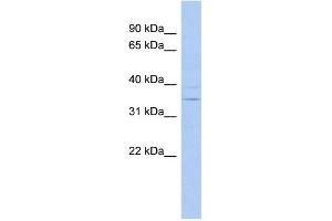 WB Suggested Anti-ASPDH Antibody Titration: 0. (ASPDH Antikörper  (N-Term))