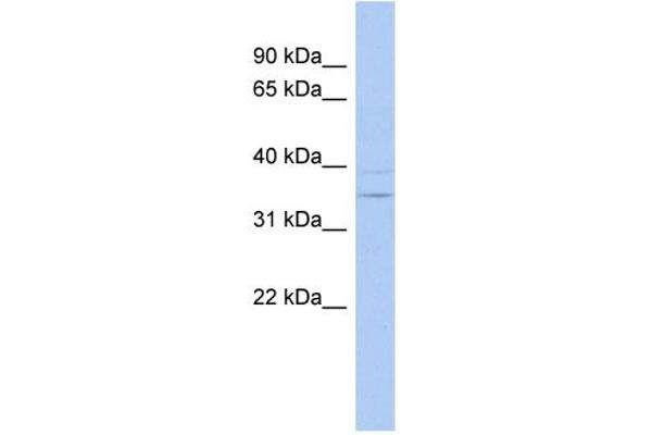 ASPDH anticorps  (N-Term)