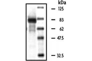 Western Blotting (WB) image for Macrophage Stimulating 1 (Hepatocyte Growth Factor-Like) (MST1) (Active) protein (ABIN2669400)