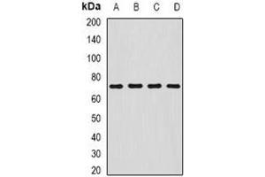 Western blot analysis of SDHA expression in HepG2 (A), MCF7 (B), mouse liver (C), mouse stomach (D) whole cell lysates. (SDHA Antikörper)
