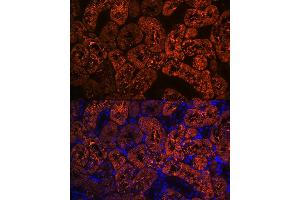 Immunofluorescence (IF) image for anti-Fructose-1,6-Bisphosphatase 1 (FBP1) antibody (ABIN7267269)