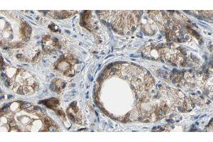 ABIN6277180 at 1/100 staining Human prostate tissue by IHC-P. (ABCC4 Antikörper)