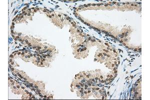 Immunohistochemical staining of paraffin-embedded pancreas tissue using anti-ERCC1 mouse monoclonal antibody. (ERCC1 Antikörper)