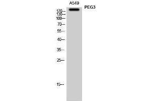 Western Blotting (WB) image for anti-Paternally Expressed 3 (PEG3) (Internal Region) antibody (ABIN3186389)