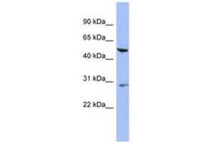 Image no. 1 for anti-Keratin 75 (KRT75) (N-Term) antibody (ABIN6744317) (Keratin 75 Antikörper  (N-Term))