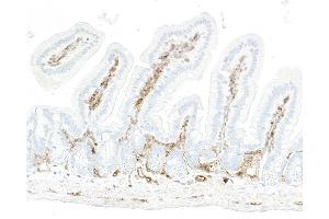 Immunohistochemistry (IHC) image for anti-Ectonucleoside Triphosphate diphosphohydrolase 1 (ENTPD1) (AA 300-350) antibody (ABIN7795686)