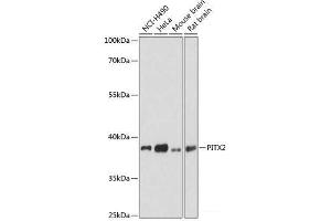 Western blot analysis of extracts of various cell lines using PITX2 Polyclonal Antibody at dilution of 1:3000. (PITX2 Antikörper)