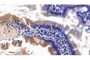 Detection of AXIN in Rat Small intestine Tissue using Polyclonal Antibody to Axis Inhibition Protein (AXIN) (Axin Antikörper  (AA 618-827))