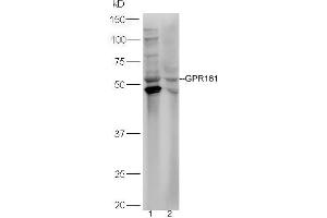 Lane 1: HepG2 lysates Lane 2: HL-60  lysates probed with Rabbit Anti-GPR161 Polyclonal Antibody, Unconjugated (ABIN2174751) at 1:300 overnight at 4 °C. (GPR161 Antikörper  (AA 121-220))
