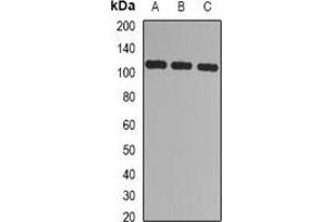Western blot analysis of CBLB expression in Jurkat (A), 293T (B), mouse spleen (C) whole cell lysates.
