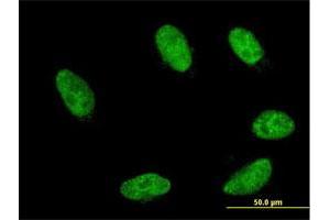 Immunofluorescence of monoclonal antibody to GBX2 on HeLa cell. (GBX2 Antikörper  (AA 114-182))