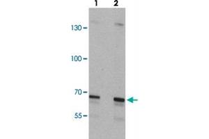 Western blot analysis of SLC27A6 in A-20 cell lysate with SLC27A6 polyclonal antibody  at (lane 1) 1 and (lane 2) 2 ug/mL. (SLC27A6 Antikörper  (N-Term))