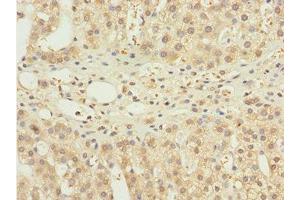 Immunohistochemistry of paraffin-embedded human adrenal gland tissue using ABIN7161518 at dilution of 1:100 (NBR1 Antikörper  (AA 1-280))