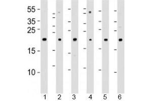 Western blot analysis of lysate from 1) 293T, 2) HeLa, 3) Jurkat, 4) Y79 cell line , 5) mouse spleen and 6) rat kidney tissue lysate using DHFR antibody at 1:1000. (Dihydrofolate Reductase Antikörper  (AA 1-50))