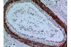 Immunohistochemistry (IHC) analysis of paraffin-embedded Human Brain, antibody was diluted at 1:100. (CYP11A1 Antikörper  (C-Term))