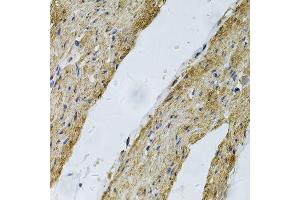 Immunohistochemistry of paraffin-embedded human smooth muscle using VCL Antibody. (Vinculin Antikörper  (AA 767-1066))