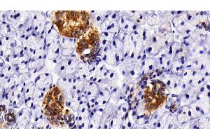 Immunohistochemistry (IHC) image for anti-Keratin 7 (KRT7) (AA 91-394) antibody (ABIN7432025)