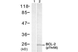 Image no. 1 for anti-B-Cell CLL/lymphoma 2 (BCL2) (pThr56) antibody (ABIN273337) (Bcl-2 Antikörper  (pThr56))