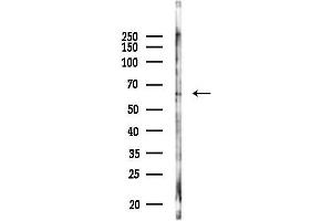 Western blot analysis of lysates from COLO205 cells(heat-shock,45 min treatment), using Phospho-CDC25A (Ser75)[Ser76] Antibody at 1/1000 dilution.