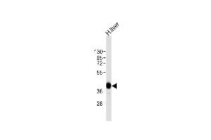 Anti-AGXT Antibody (Center)at 1:8000 dilution + human liver lysates Lysates/proteins at 20 μg per lane.