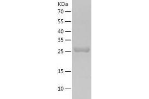 Western Blotting (WB) image for 6-phosphogluconolactonase (PGLS) (AA 1-258) protein (His tag) (ABIN7121626)