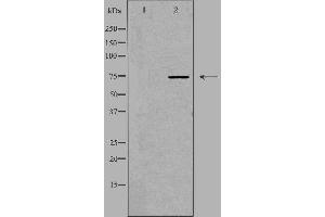 Western blot analysis of extracts from HT-29 cells, using ACS2L antibody.