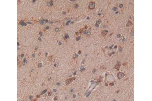 Used in DAB staining on fromalin fixed paraffin- embedded brain tissue (NAT8L Antikörper  (AA 1-302))