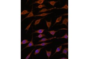 Immunofluorescence (IF) image for anti-Asparagine-Linked Glycosylation 5, Dolichyl-Phosphate beta-Glucosyltransferase Homolog (S. Cerevisiae) (ALG5) (AA 34-190) antibody (ABIN7265696)
