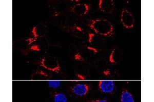 Immunofluorescence analysis of HeLa cells using USO1 Polyclonal Antibody at dilution of 1:200 (60x lens). (USO1 Antikörper)