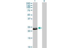 Western Blot analysis of PRL expression in transfected 293T cell line by PRL MaxPab polyclonal antibody. (Prolactin Antikörper  (AA 1-227))