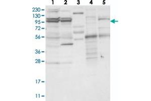Western blot analysis of Lane 1: RT-4, Lane 2: U-251 MG, Lane 3: Human Plasma, Lane 4: Liver, Lane 5: Tonsil with TBC1D5 polyclonal antibody . (TBC1D5 Antikörper)