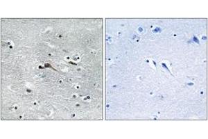 Immunohistochemistry (IHC) image for anti-Cytokine-Like 1 (CYTL1) (AA 61-110) antibody (ABIN6766393) (CYTL1 Antikörper  (AA 61-110))