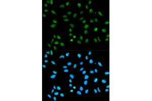 Immunofluorescence analysis of HeLa cells using HNRNPA2B1 antibody (ABIN5970508). (HNRNPA2B1 Antikörper)