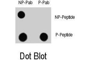 Dot blot analysis of MAP1LC3A (phospho S12) polyclonal antibody  and Nonphospho-MAP1LC3 antibody on nitrocellulose membrane. (MAP1LC3A Antikörper  (pSer12))