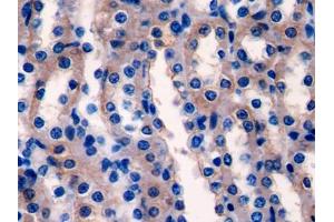 DAB staining on IHC-P; Samples: Rat Kidney Tissue (Ladinin 1 Antikörper  (AA 1-140))