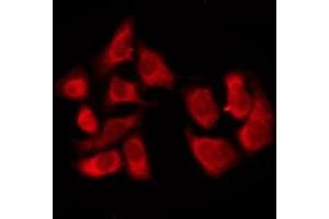 ABIN6276229 staining COLO205 by IF/ICC. (TAS2R8 Antikörper  (Internal Region))