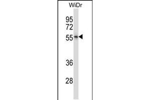 Western blot analysis in WiDr cell line lysates (35ug/lane). (NR2E3 Antikörper  (AA 170-198))